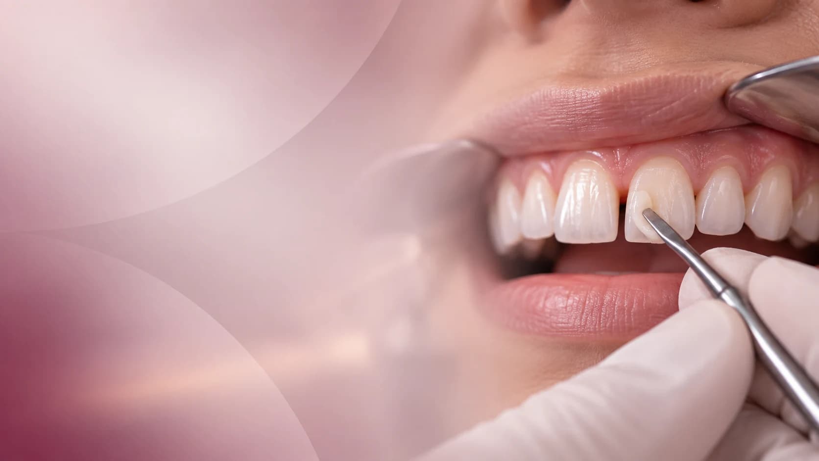 Avaliação odontológica de espaçamento entre os dentes anteriores
