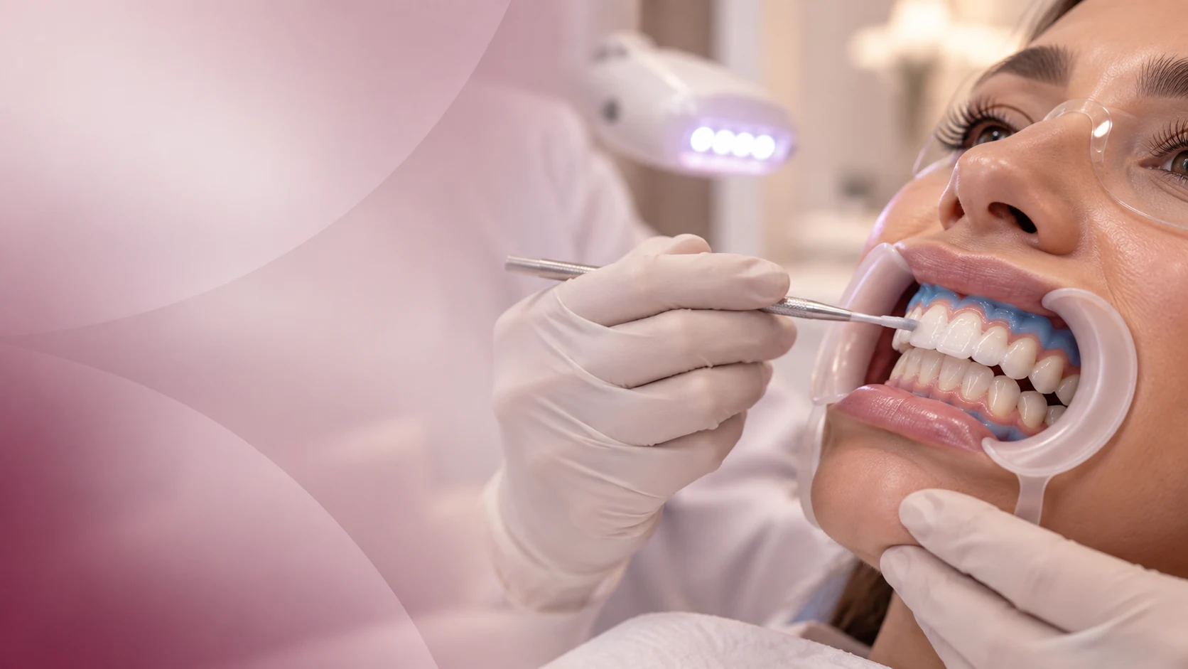 Procedimento clínico de clareamento dental com iluminação odontológica