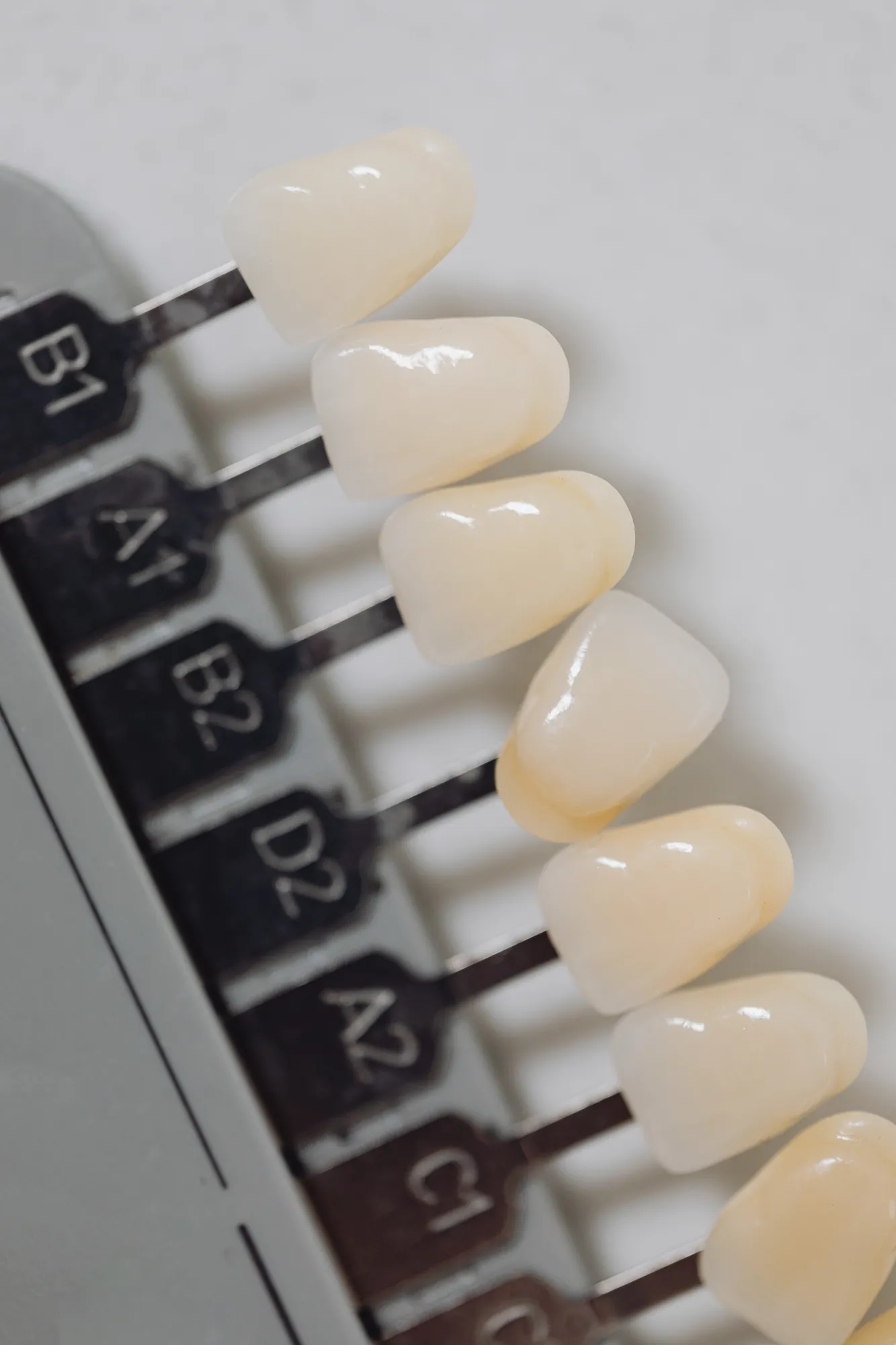 Imagem ilustrativa: lentes de contato dental